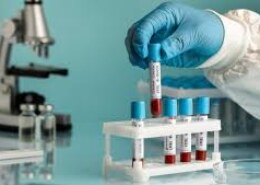 Optimize Revenue with Professional Laboratory Billing Service