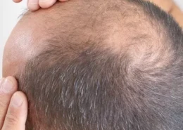 G Cell Treatment in Dubai & Abu Dhabi for Skin Brightening | Glamorous Clinic in Dubai