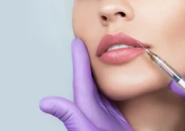 Russian Lip Fillers in Dubai & Abu Dhabi for Plump Yet Natural Lips | Glamorous Clinic in Dubai