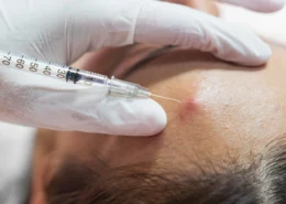 Fast-Acting Steroid Injections in Dubai & Abu Dhabi | Glamorous Clinic in Dubai