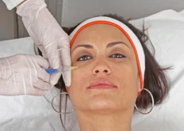 Modern Under Eye Fillers in Dubai | Glamorous Clinic in Dubai
