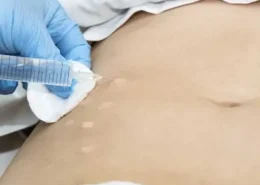 Non-Surgical Slimming Treatments Dubai | Glamorous Clinic in Dubai