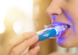 Teeth Whitening Lahore for a Confident White Smile